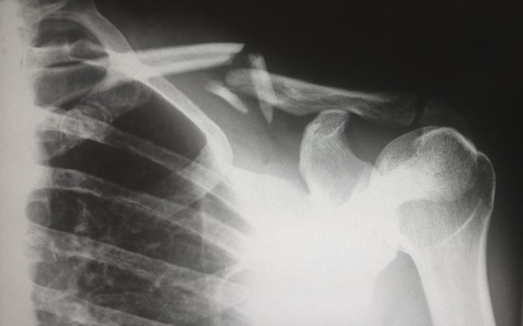 Que es un RIS: Sistema de Informacion Radiologica Explicado